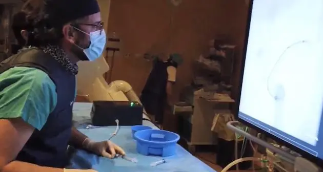 Ospedale Belcolle, prima simulazione del trattamento di aneurismi con stampa 3D