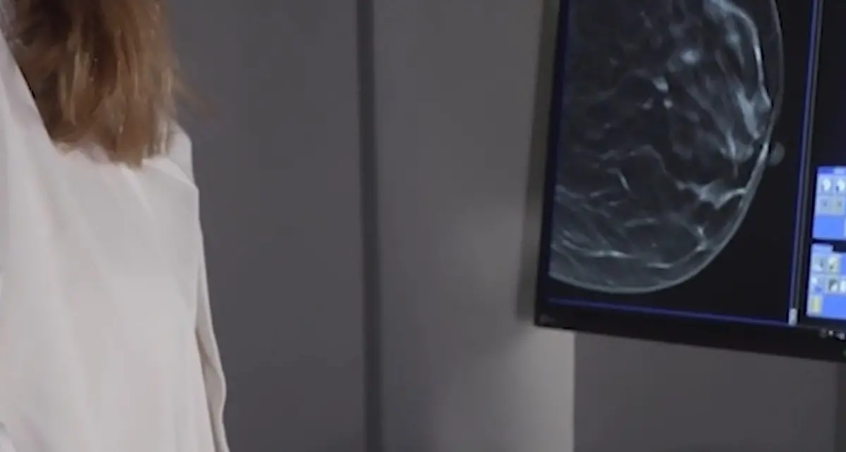 Tumori: per prevenzione carcinoma mammella a SYNLAB Manifattura Firenze nuovo mammografo 3D