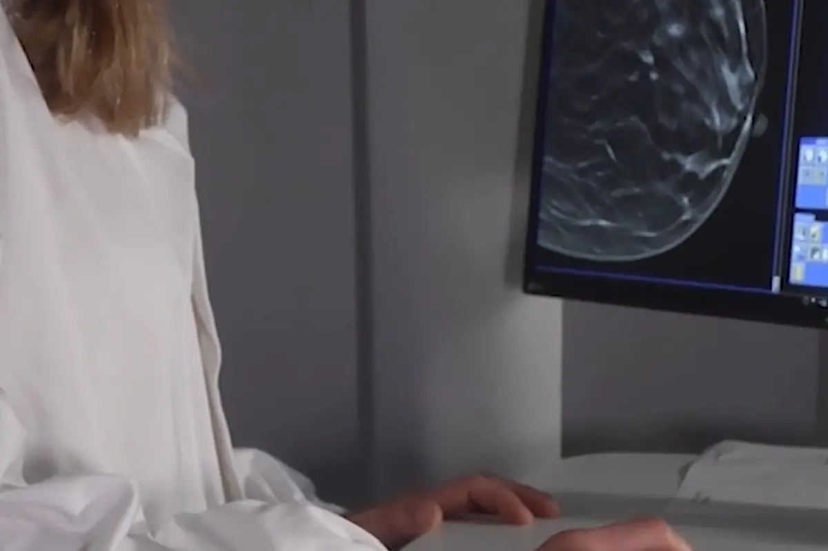 Tumori: per prevenzione carcinoma mammella a SYNLAB Manifattura Firenze nuovo mammografo 3D